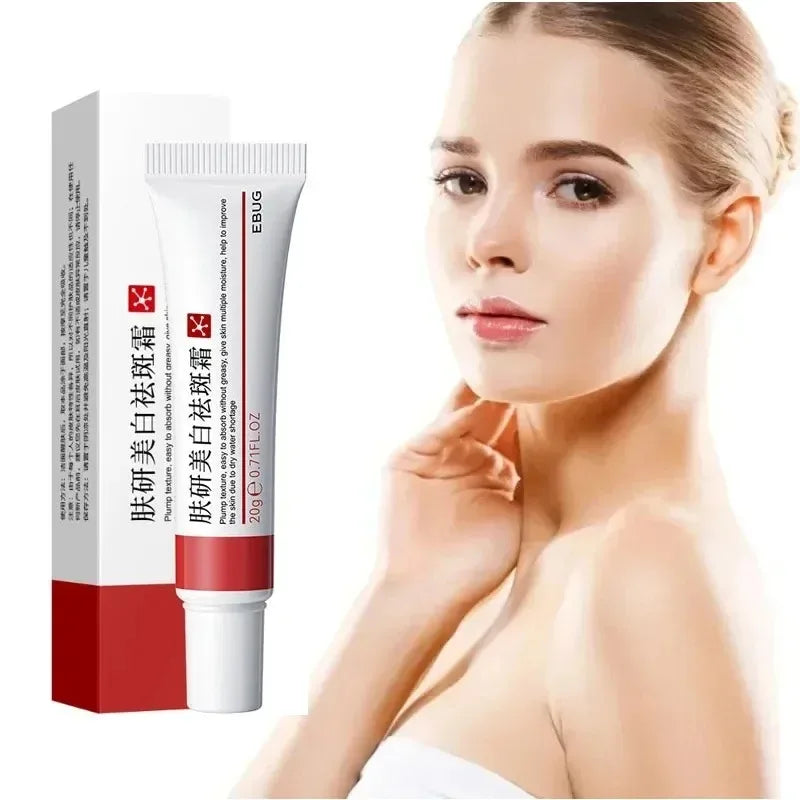 1/3/5pc Effective Freckle Cream Facial Fast Brighten Face Remove Melasma Dark Spot Fade Melanin pigmentation Improve Dullness