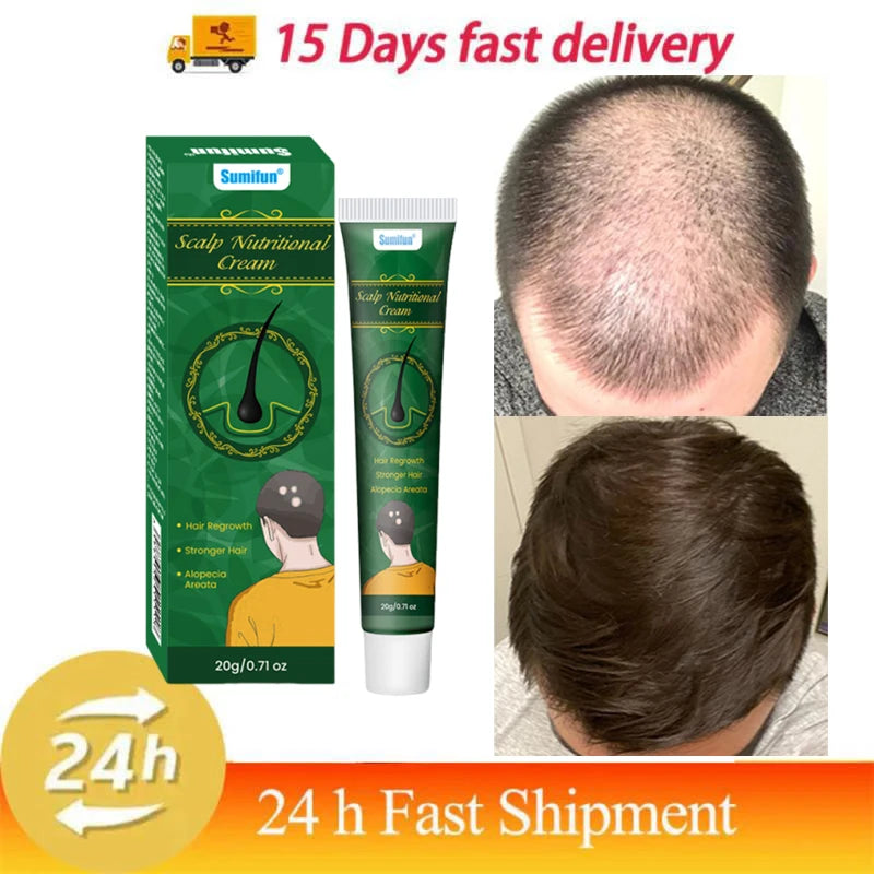 8 Days Fast Hair Growth Cream Anti Hair Loss Prevent Baldness Scalp Treatment Repair Roots Beauty Health Hair Care For Men Women
