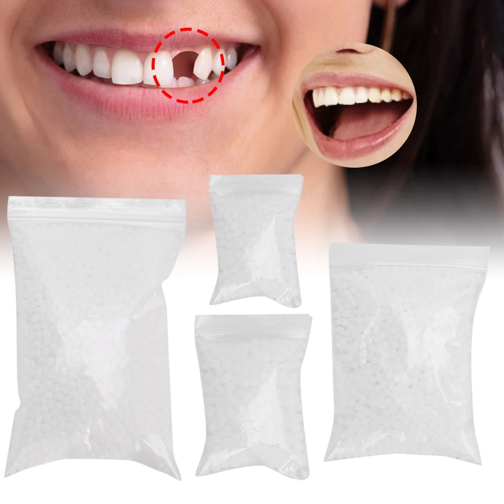 Tooth Repair Bead Broken Teeth Repair Temporary Tooth Repair Beads for Missing Broken Teeth Dental Tooth Filling Material