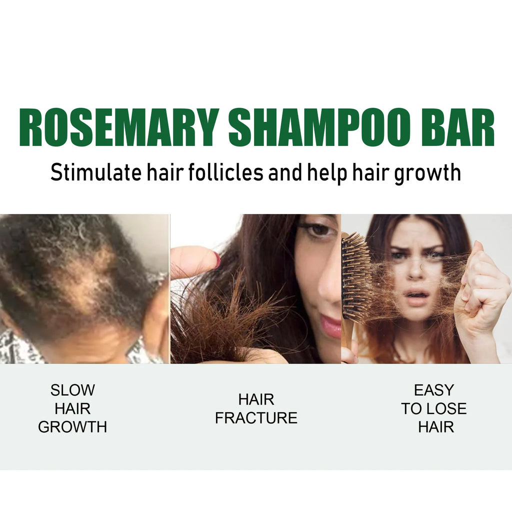 Anti Itching Hair Soap Preventing Hairs Loss Baldness Scalp Treatment Cleaning Repairing Nourishing Fast Hair Growth Shampoo Bar