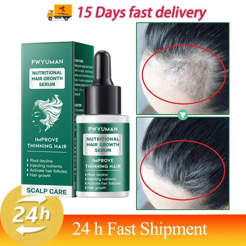 8 Days Fast Hair Growth Cream Anti Hair Loss Prevent Baldness Scalp Treatment Repair Roots Beauty Health Hair Care For Men Women