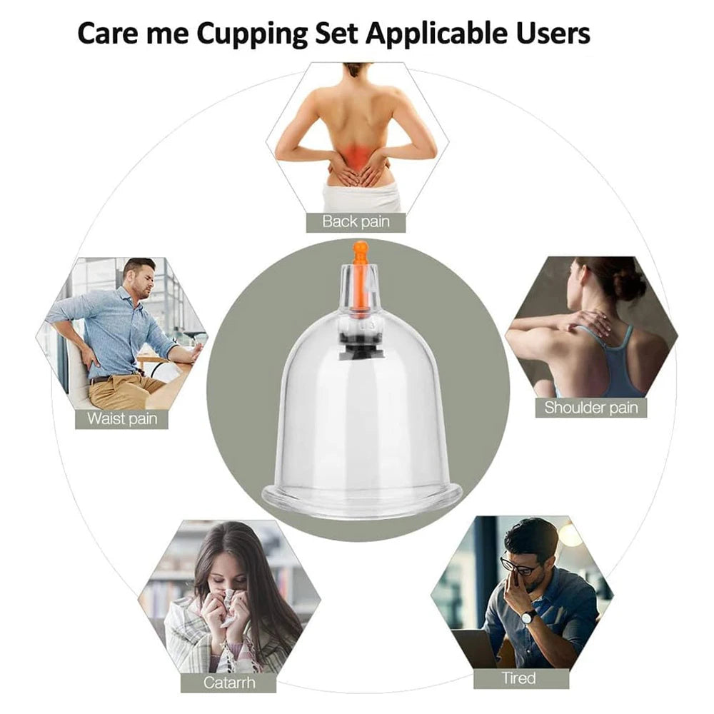 32 Can Household Thickened Vacuum Cupping Machine Non Glass Cupping Machine Health Cupping Machine Massage Tool
