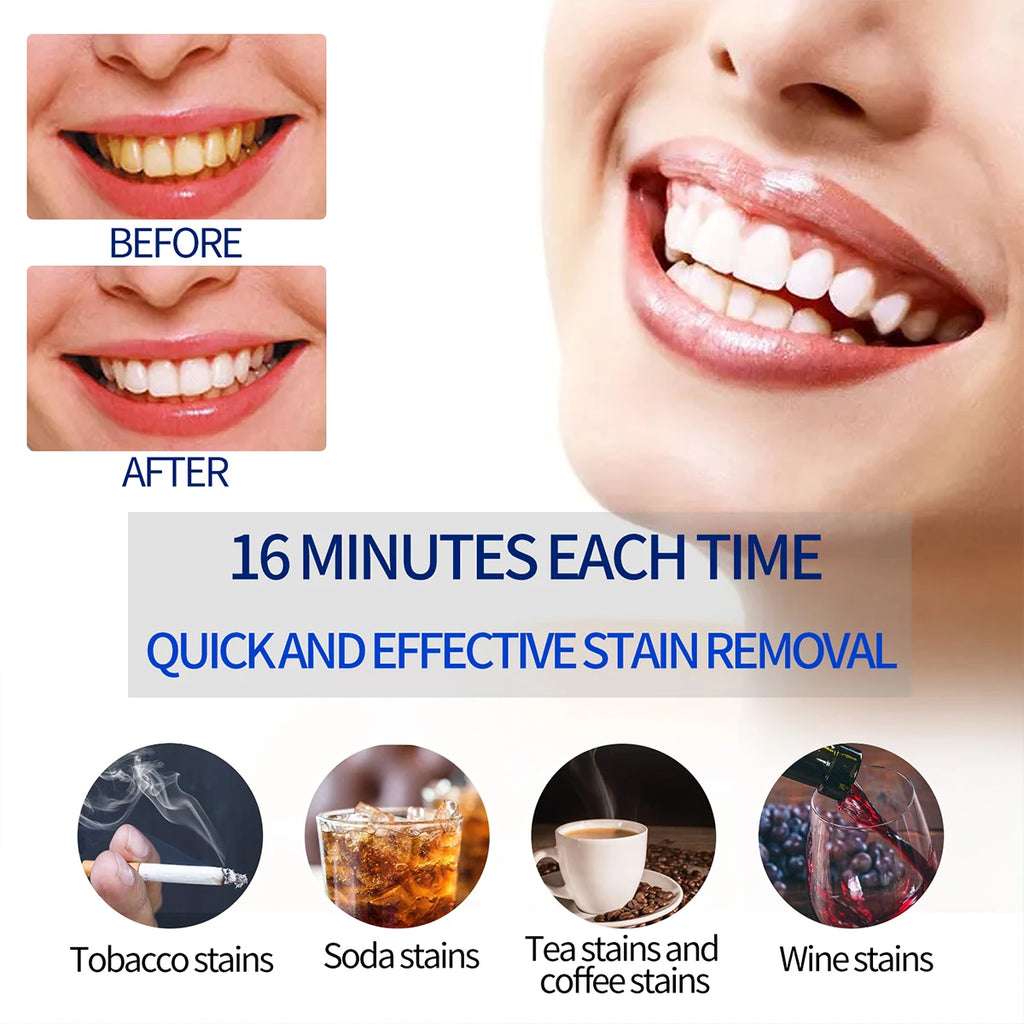 Portable Teeth Whitening Lamp with Enhanced Cold Light Gel Removes Yellow Stains from Teeth a Miracle of Oral Whitening Care