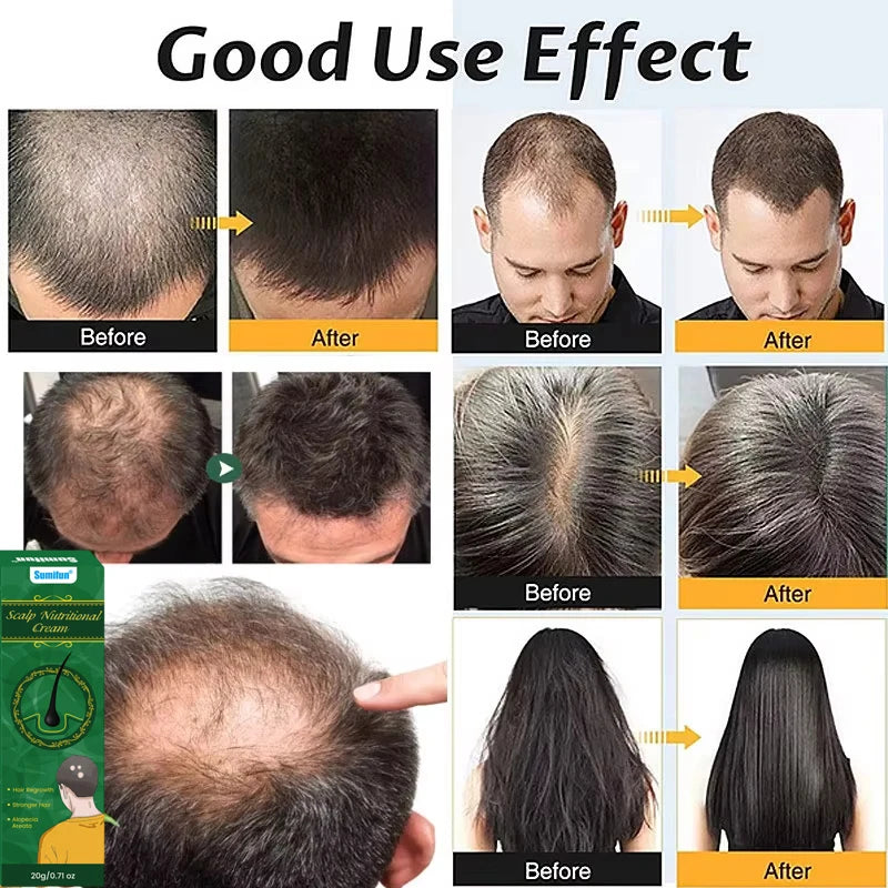8 Days Fast Hair Growth Cream Anti Hair Loss Prevent Baldness Scalp Treatment Repair Roots Beauty Health Hair Care For Men Women