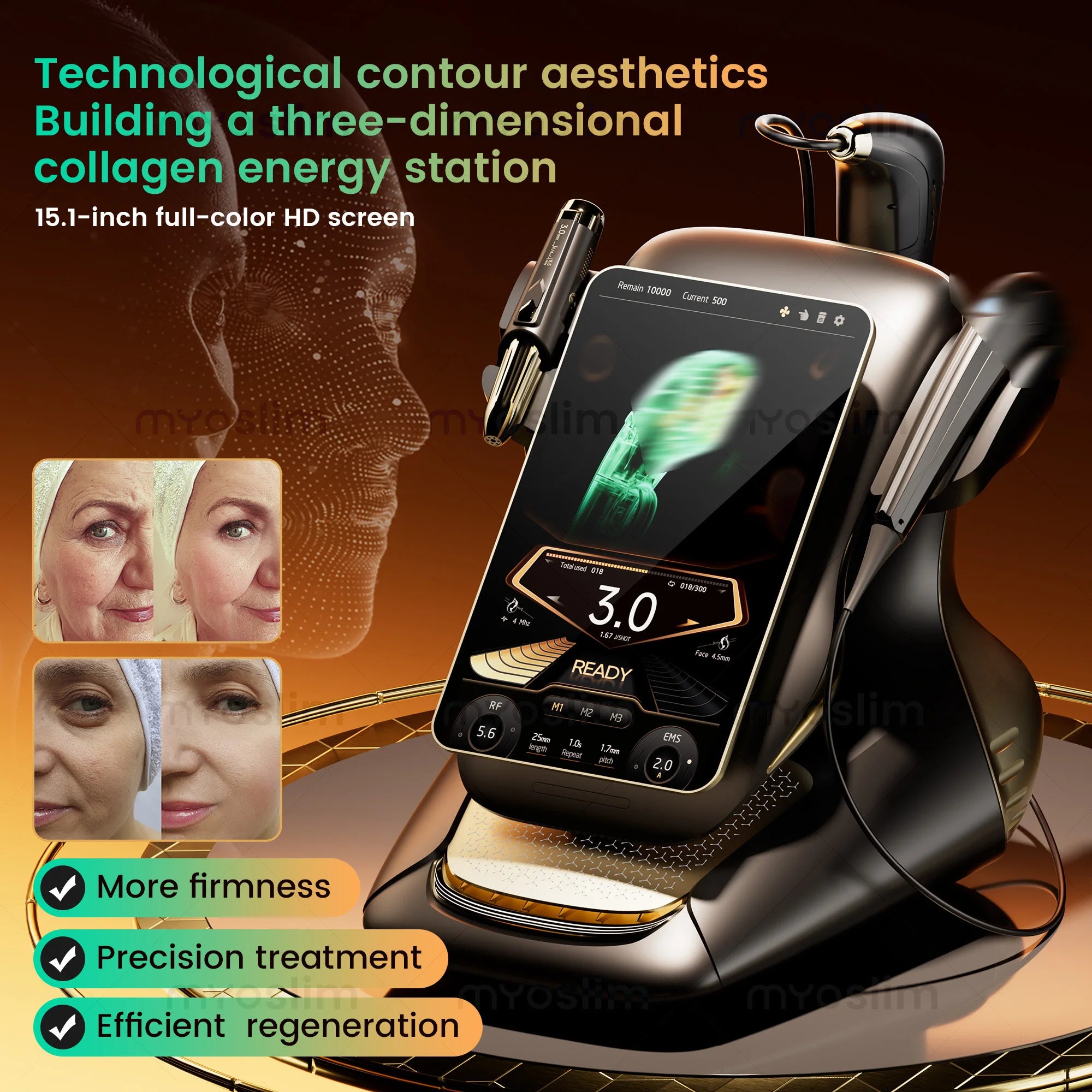 New 25D 360MAX Beauty Machine for Facial Lifting, Skin Tightening and Body Slimming Latest Salon Equipment