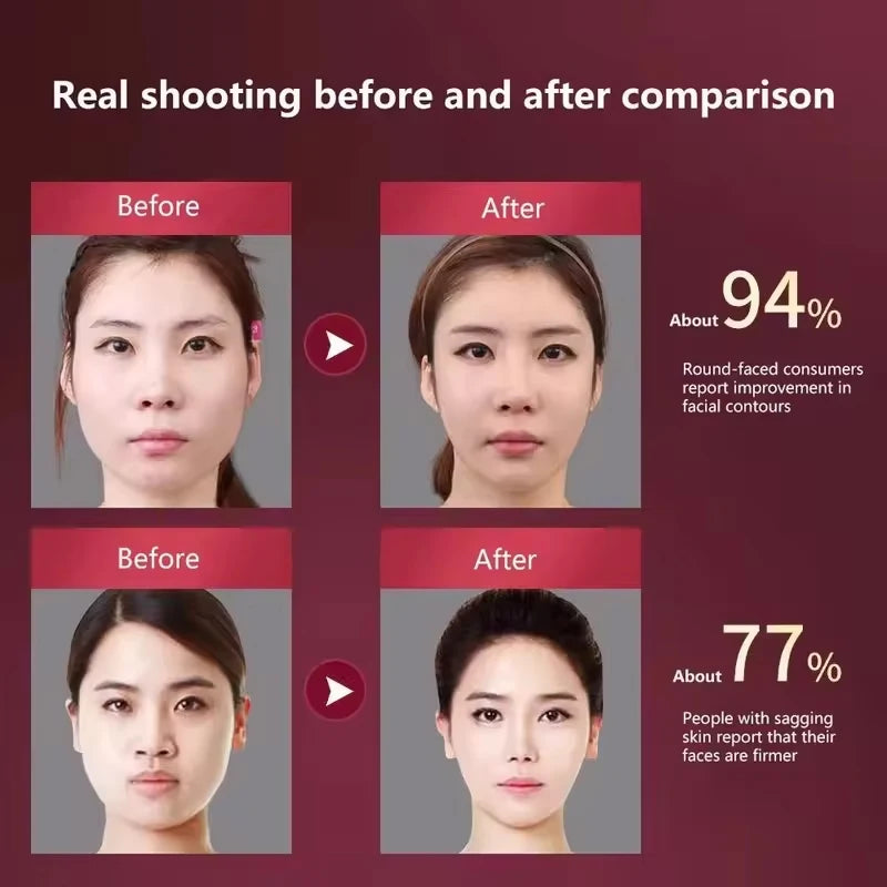 LED Photon Therapy Facial Slimming Vibration Massager Facial Lifting Device Facial Heated Double Chin V Face Vibration Massager