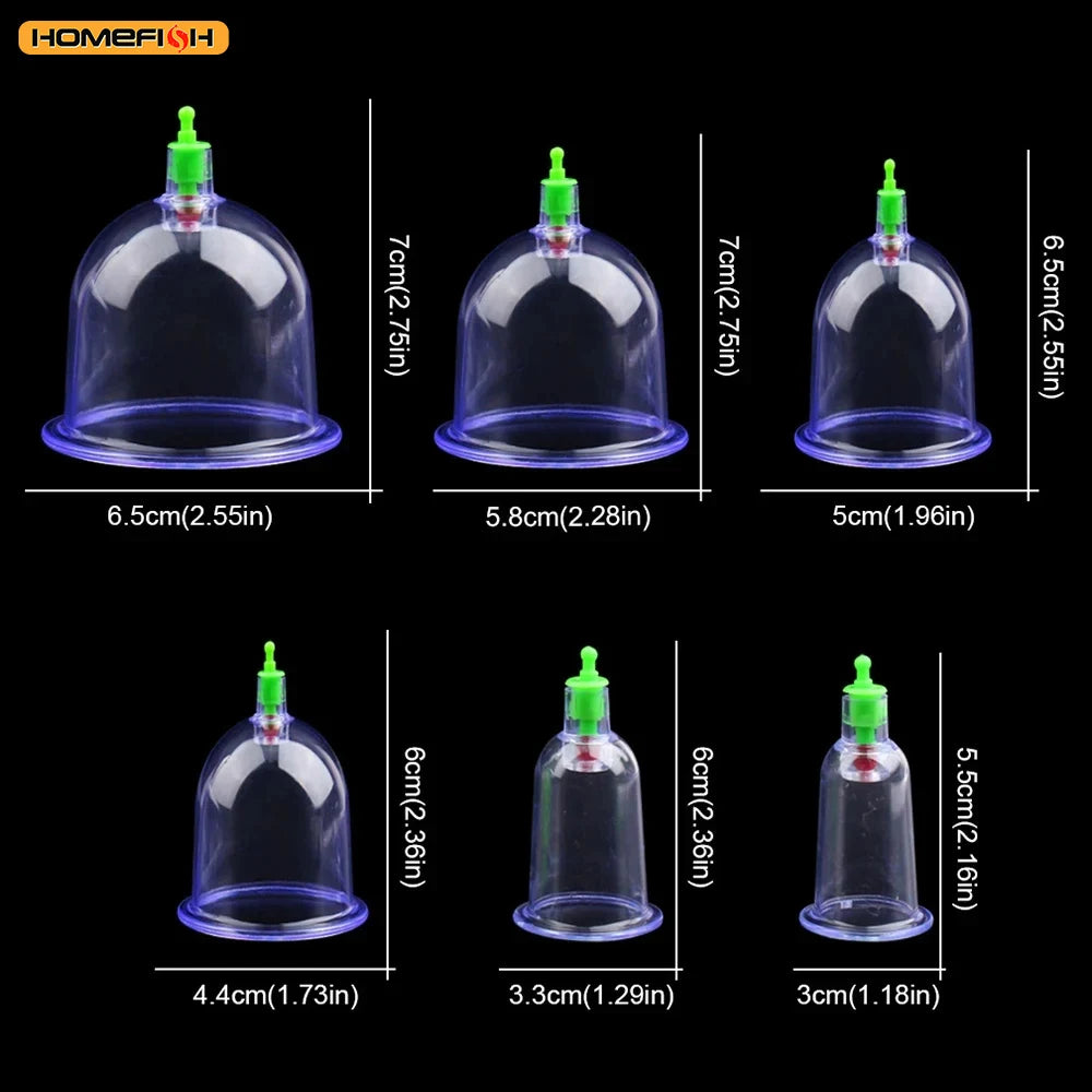 6-Piece Suction Cup Set with Hand Pump – Vacuum Cupping Tool for Back & Body Use