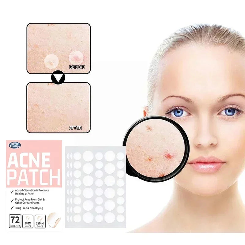 72pcs Invisible Acne Patches Waterproof Pimple Anti-Acne Hydrocolloid Patches Spots Marks Concealer Repair Sticker Skin Care