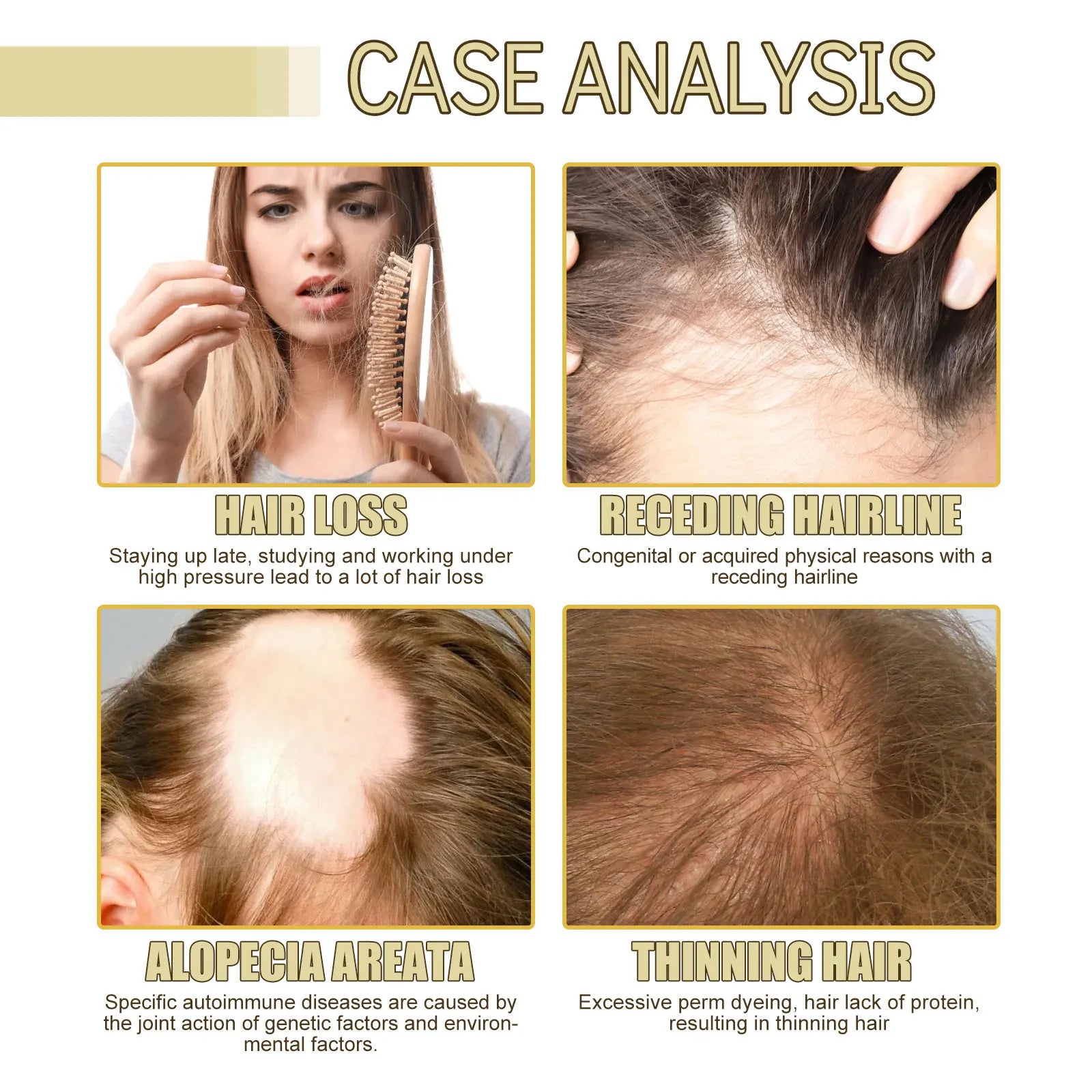 Rosemary Hair Boost Oil Strengthen Thicken Smooth Hair Improve Frizz Prevent Baldness Nourishing Scalp Repair Dense Hair Serum