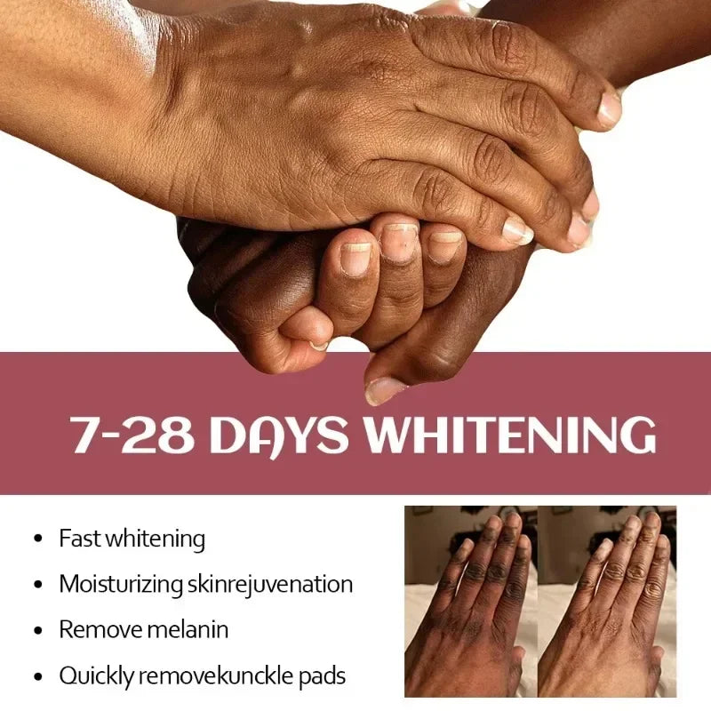Fast Whitening Dark Knuckles Brighten Hand Cream Melanin Corrector Moisturizing Intense Stains Remover Cosmetics Skin Care 2024