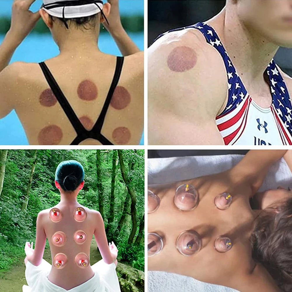 32 Can Household Thickened Vacuum Cupping Machine Non Glass Cupping Machine Health Cupping Machine Massage Tool