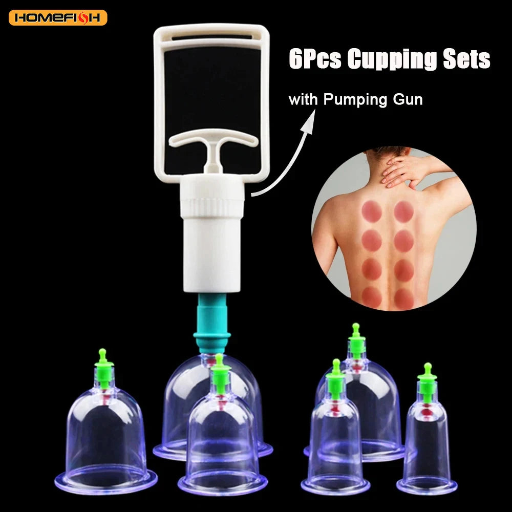 6-Piece Suction Cup Set with Hand Pump – Vacuum Cupping Tool for Back & Body Use