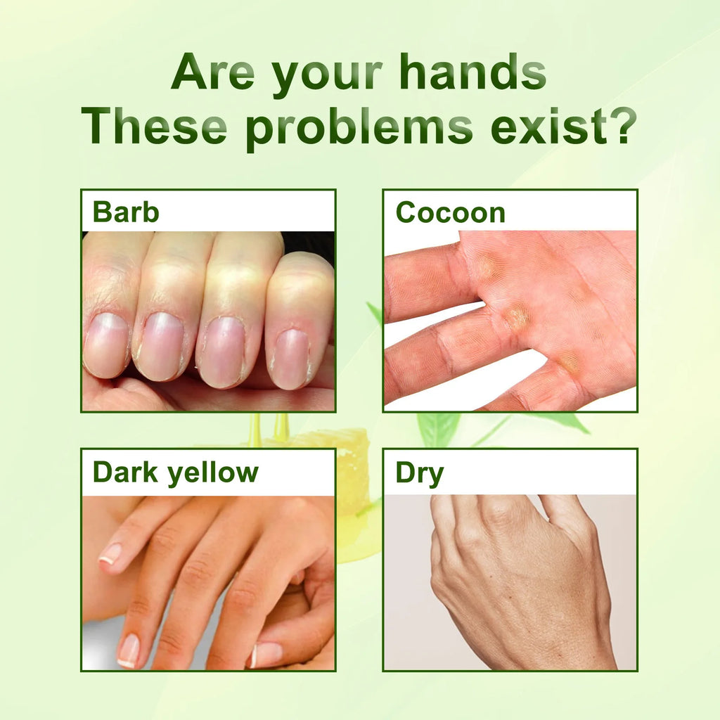 Jaysuing Green Tea Hand Mask Anti-Wri-nkle Moisturizing Wh-itening Repair Exfoliating Callus Film Nourish Hand Skin Care Cream