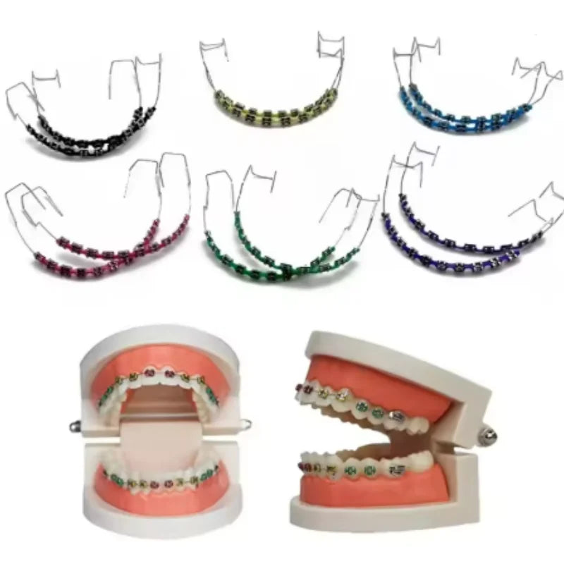 Colorful Orthodontic Ligature Ties – Eight Colors