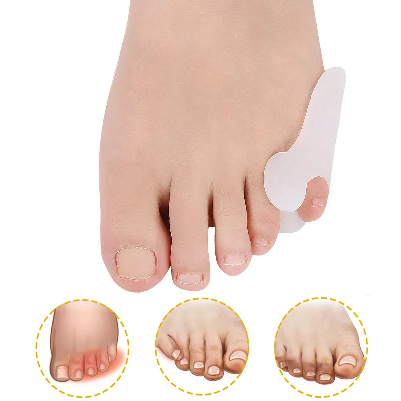 Gel Pinky Toe Separators – 2 to 20 Pack
