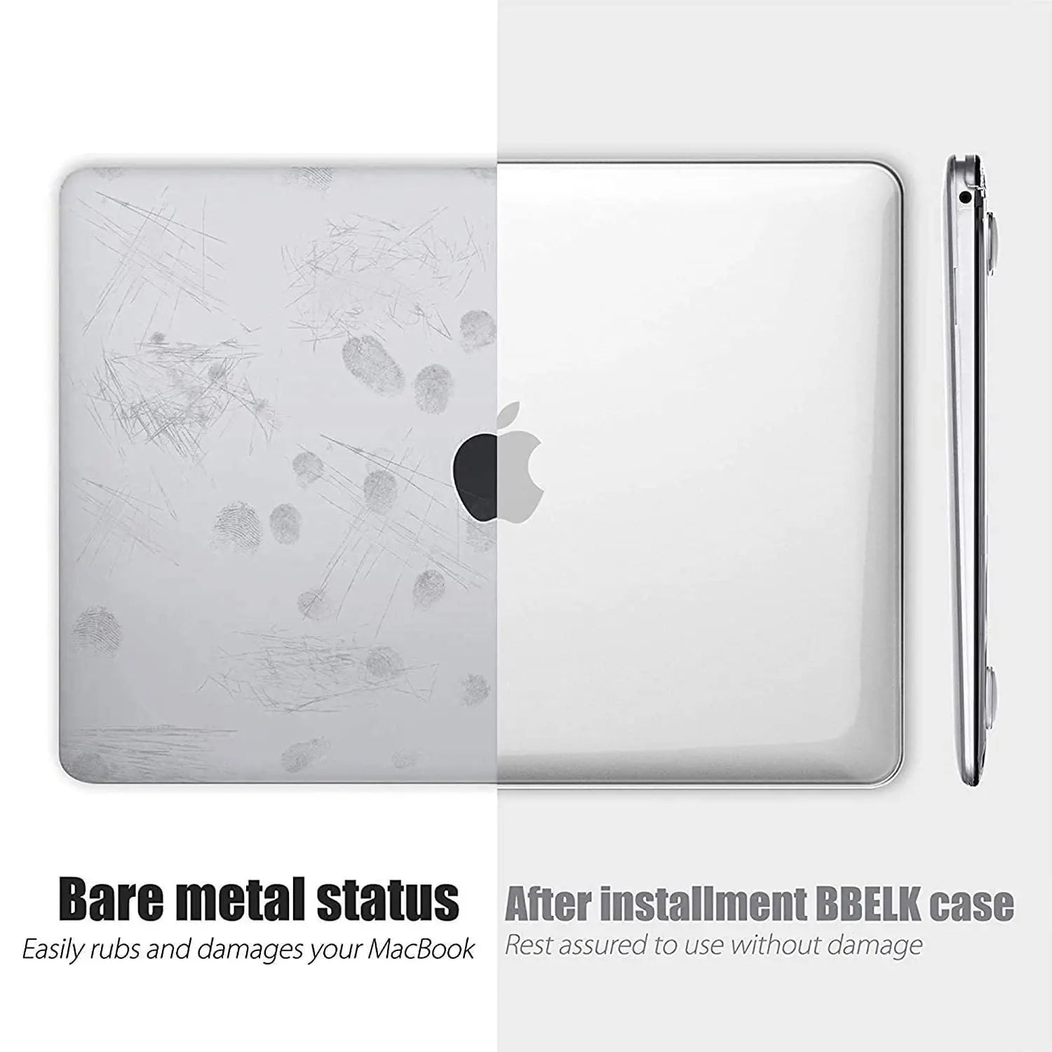 Laptop Case For Apple Macbook 13 13.6 Inch For M1 Chip Pro 13 A2338 Air 13 A2337 A2179 2022 M2 Air 13.6 Crystal Protective Cover