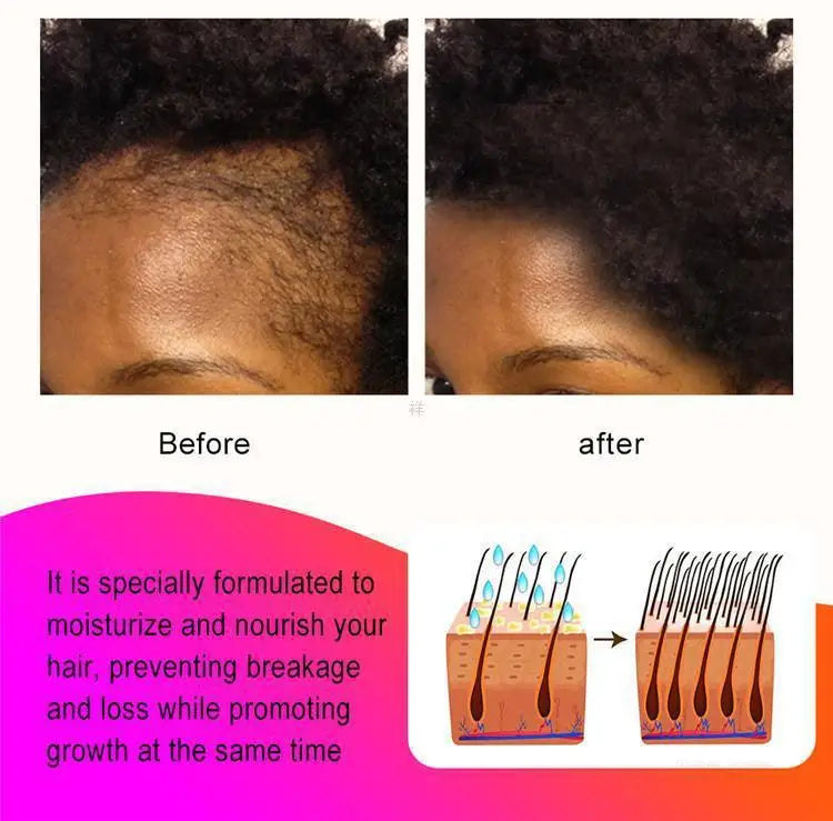 Fast Hair Growth Oil Africa Crazy Traction Treatment Hair Loss Spray Hair Regrowth Powerful Hair Root Repair Hair Mask Hair Care