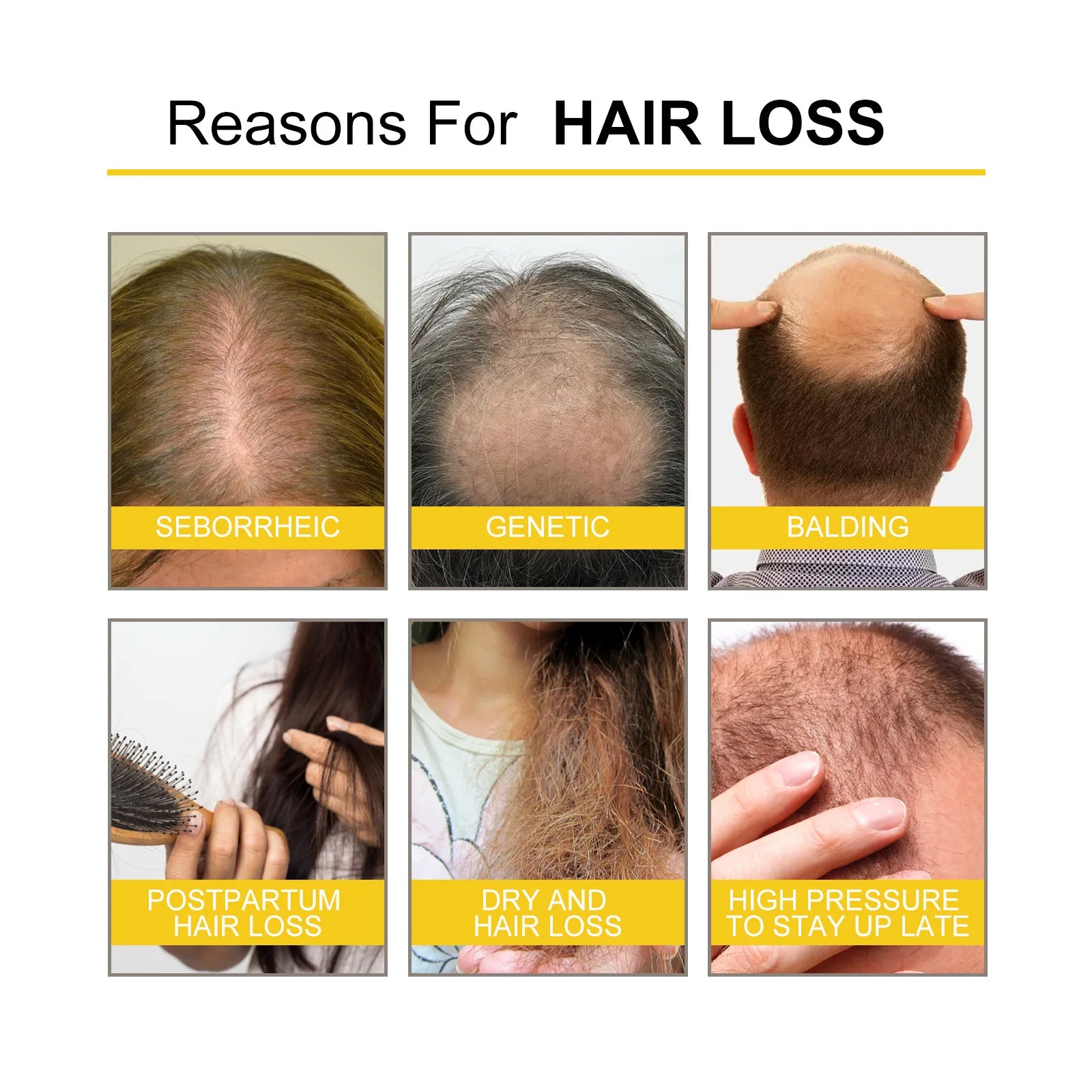Hair Growth Essential Oil Treatment Seborrheic Alopecia Follicle Repairing Reduce Hairline Baldness Dense Growing Hairs Lotion