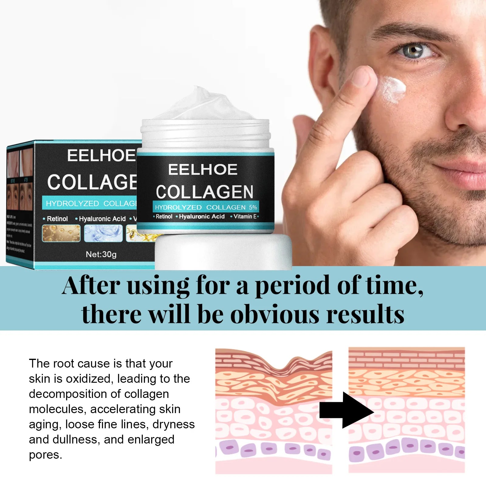 EELHOE Vitamin E Moisturizing Cream Man Improve Rough Dry Skin Tightening Nourishing Retinol Rejuvenate the Face Cream Man 50g