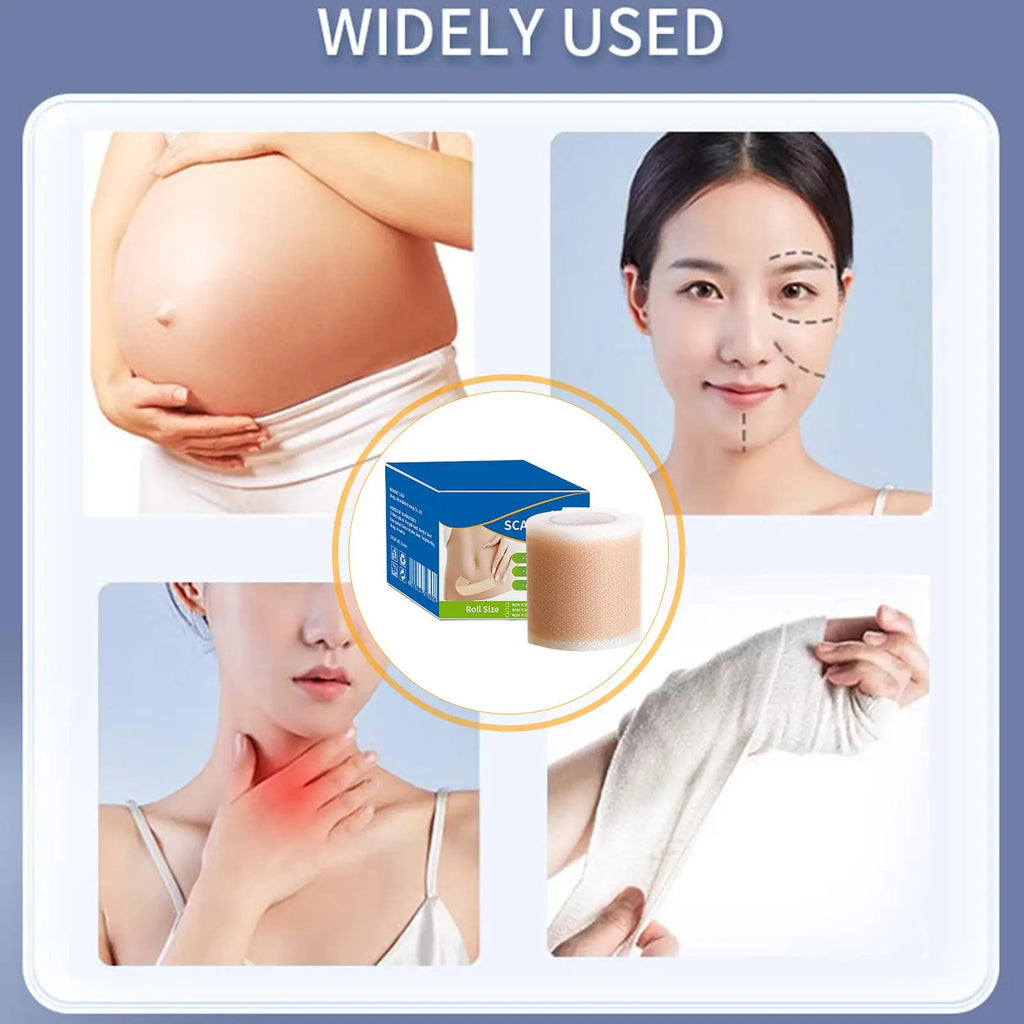Painless Scar Repair Tape Silicone Scar Removal Strip Reusable Effective Skin Care Strips For Surgerys Burn Acne Scar
