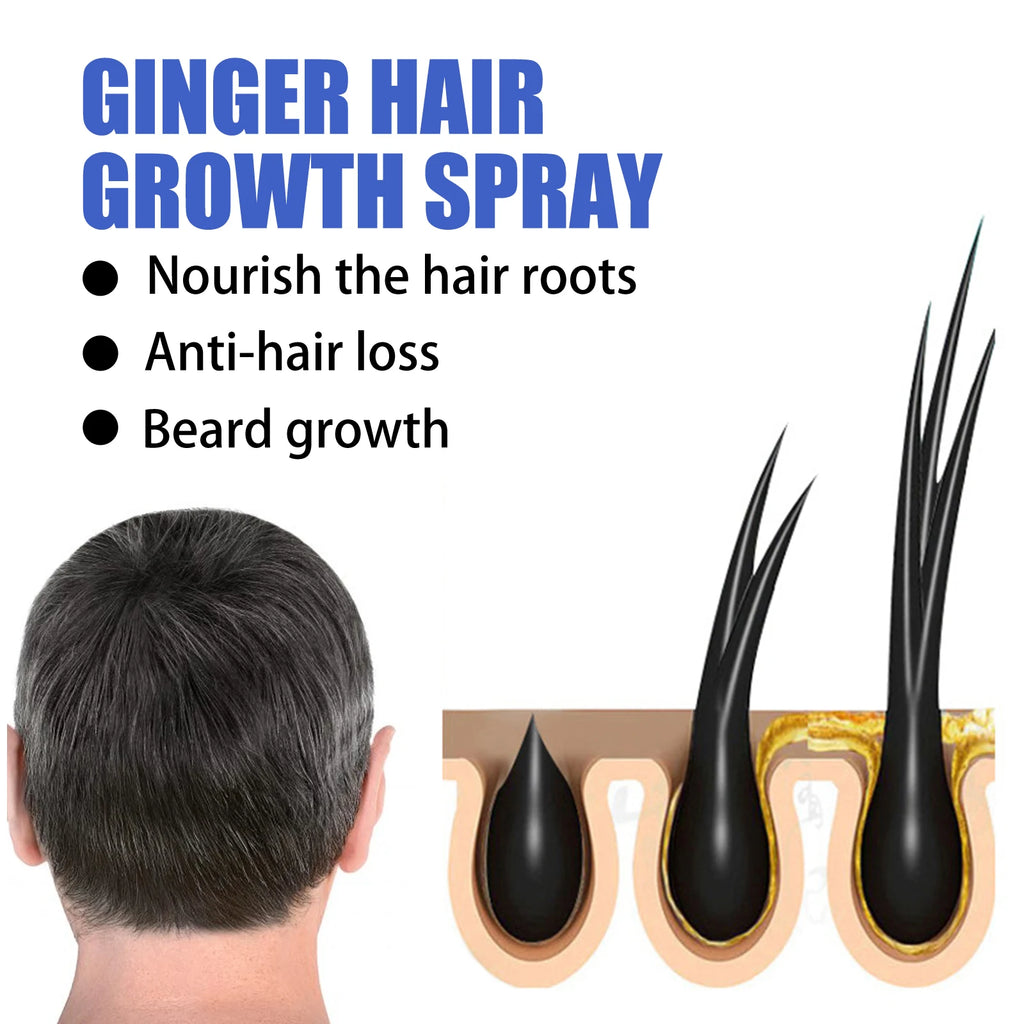 Ginger Hair Growth Spray Anti Hair Fall Hair Loss Treatment Hair Growth Essence Oil for Men Women Hair Treatment
