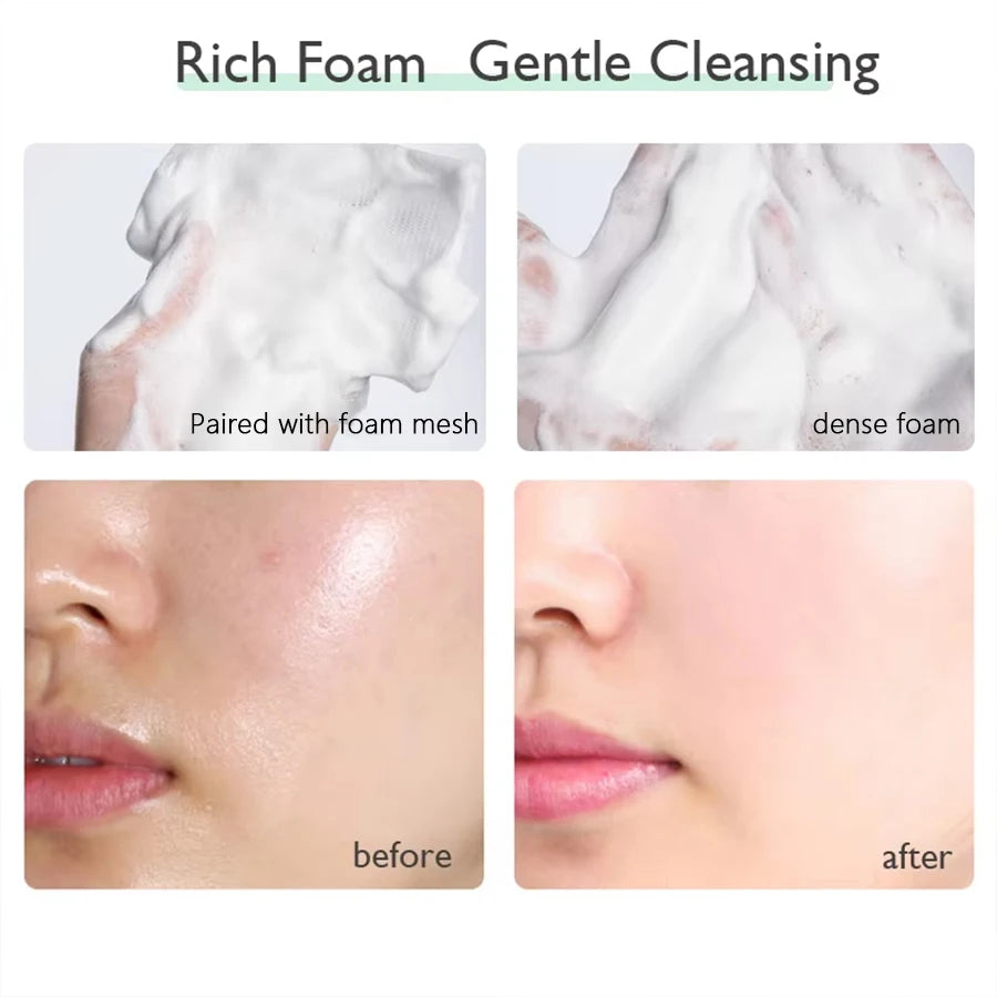 PTWOP Whitening Facial Cleanser Foam Moisturizing Deep Remove Cleansing Acne Milk Oil Control Exfoliating Shrink Pores Face Wash