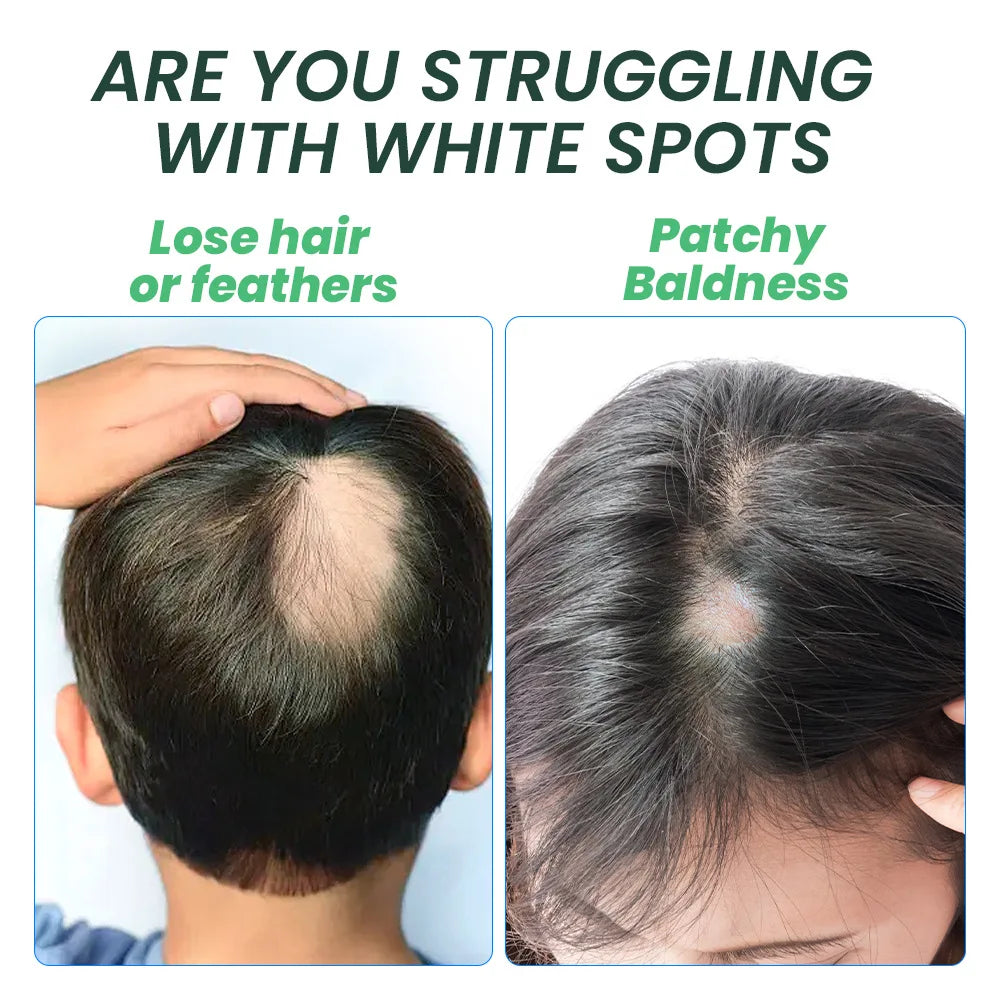 8 Days Fast Hair Growth Cream Anti Hair Loss Prevent Baldness Scalp Treatment Repair Roots Beauty Health Hair Care For Men Women