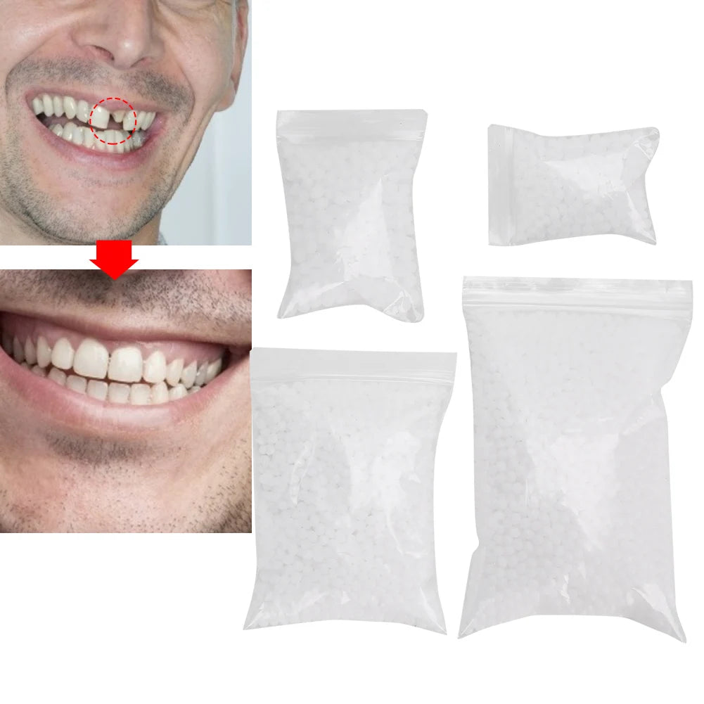 Tooth Repair Bead Broken Teeth Repair Temporary Tooth Repair Beads for Missing Broken Teeth Dental Tooth Filling Material