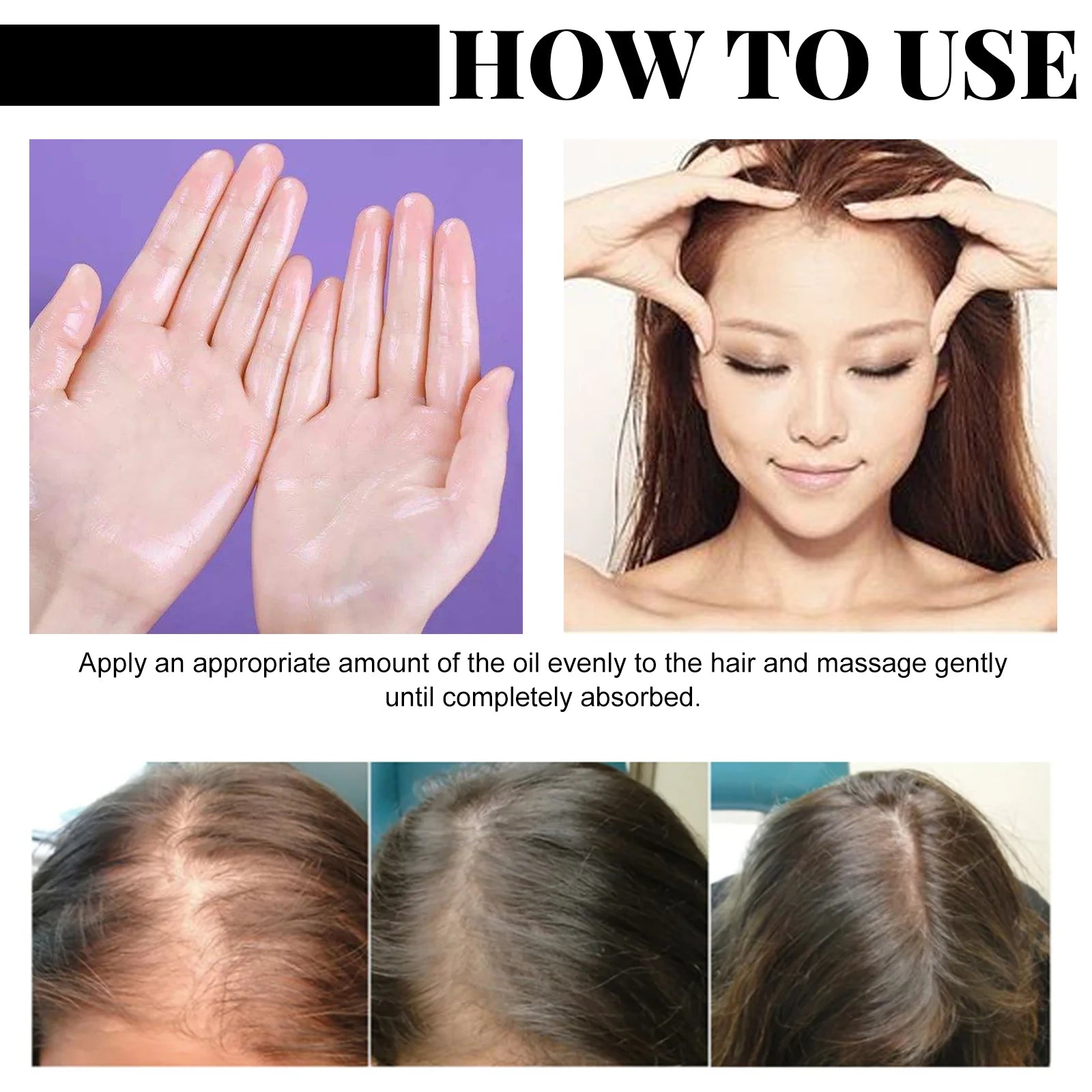Fast Hair Growth Oil Africa Crazy Traction Treatment Hair Loss Spray Hair Regrowth Powerful Hair Root Repair Hair Mask Hair Care