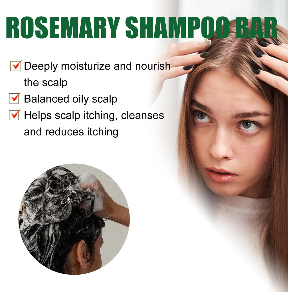 Anti Itching Hair Soap Preventing Hairs Loss Baldness Scalp Treatment Cleaning Repairing Nourishing Fast Hair Growth Shampoo Bar
