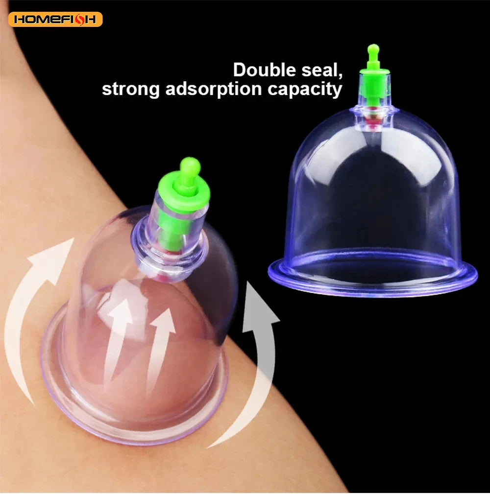 6-Piece Suction Cup Set with Hand Pump – Vacuum Cupping Tool for Back & Body Use
