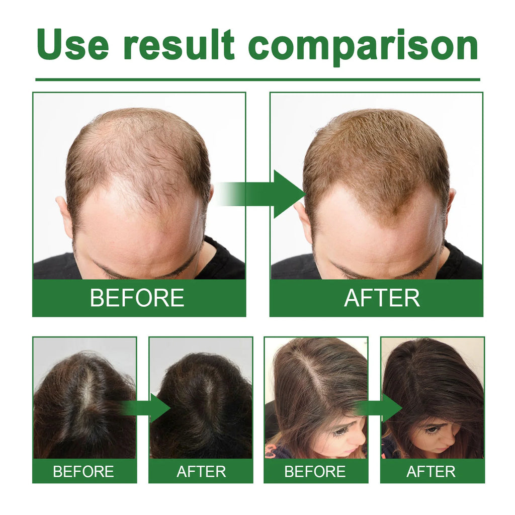 Rosemary Spray for Hair Nourishing Scalp Treatment Strengthen Hair Loss Care Split Ends Remover Organic Hair Growth Spray 30ml