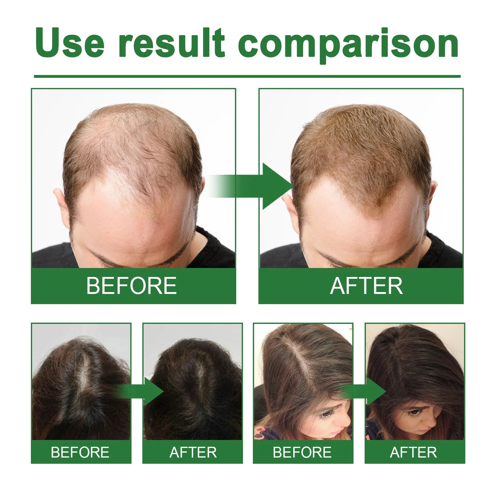 Rosemary Spray for Hair Nourishing Scalp Treatment Strengthen Hair Loss Care Split Ends Remover Organic Hair Growth Spray 30ml