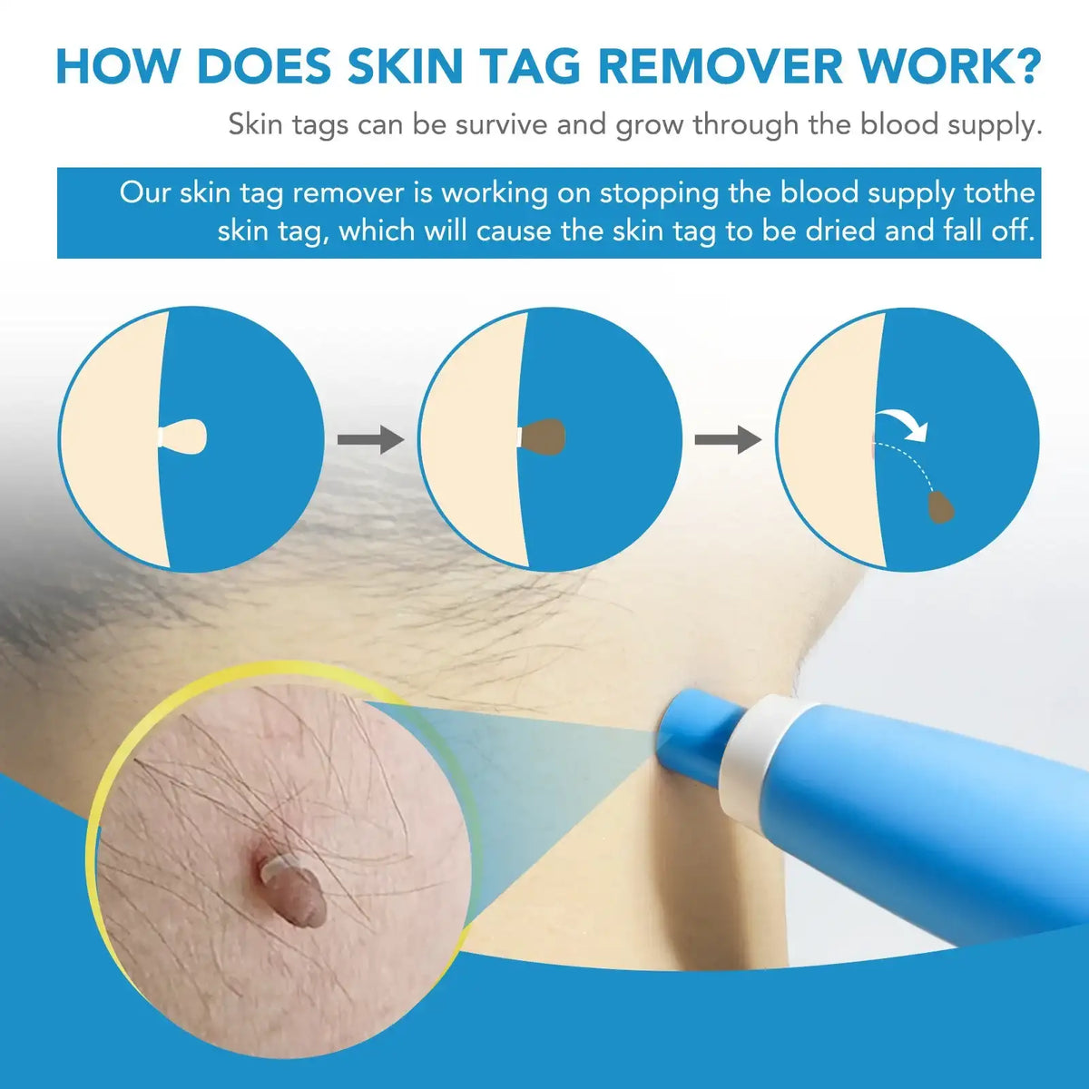 Automatic Skin Care Band Tool Kit