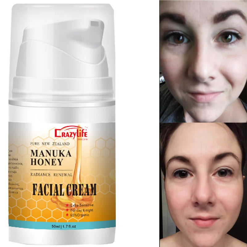 50ml NewZealand Bee Venom Honey Facial Cream Firming Lifting Skin Treatment Facial Cream Night Cream Anti Aging Wrinkles