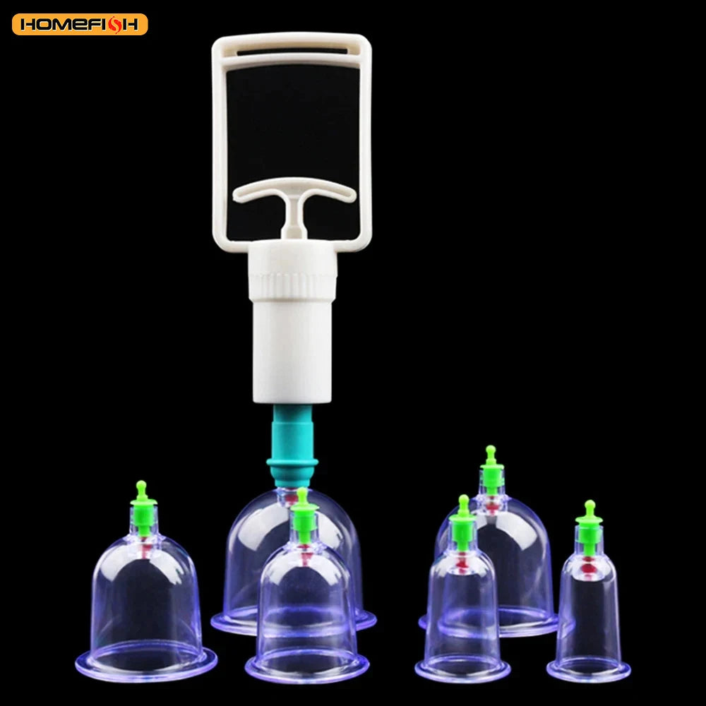 6-Piece Suction Cup Set with Hand Pump – Vacuum Cupping Tool for Back & Body Use
