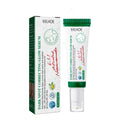 Whitening Freckle Serum Fade Pigmentation Moisturizing Brightening Improve Dull Anti Aging Remove Dark Spots Face Care Essence