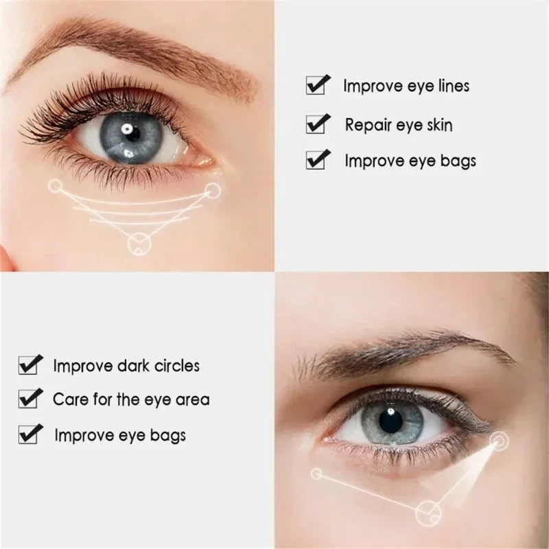 Nicotinamide Eyes Cream Dark Circles Fading Eye Bags Eye Hyaluronic Acid Moisturizing Serum Against Puffiness Eye Care Gel