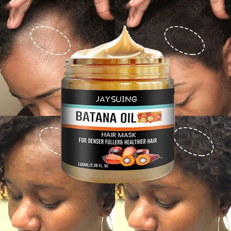 Fast Hair Growth Oil Africa Crazy Traction Treatment Hair Loss Spray Hair Regrowth Powerful Hair Root Repair Hair Mask Hair Care