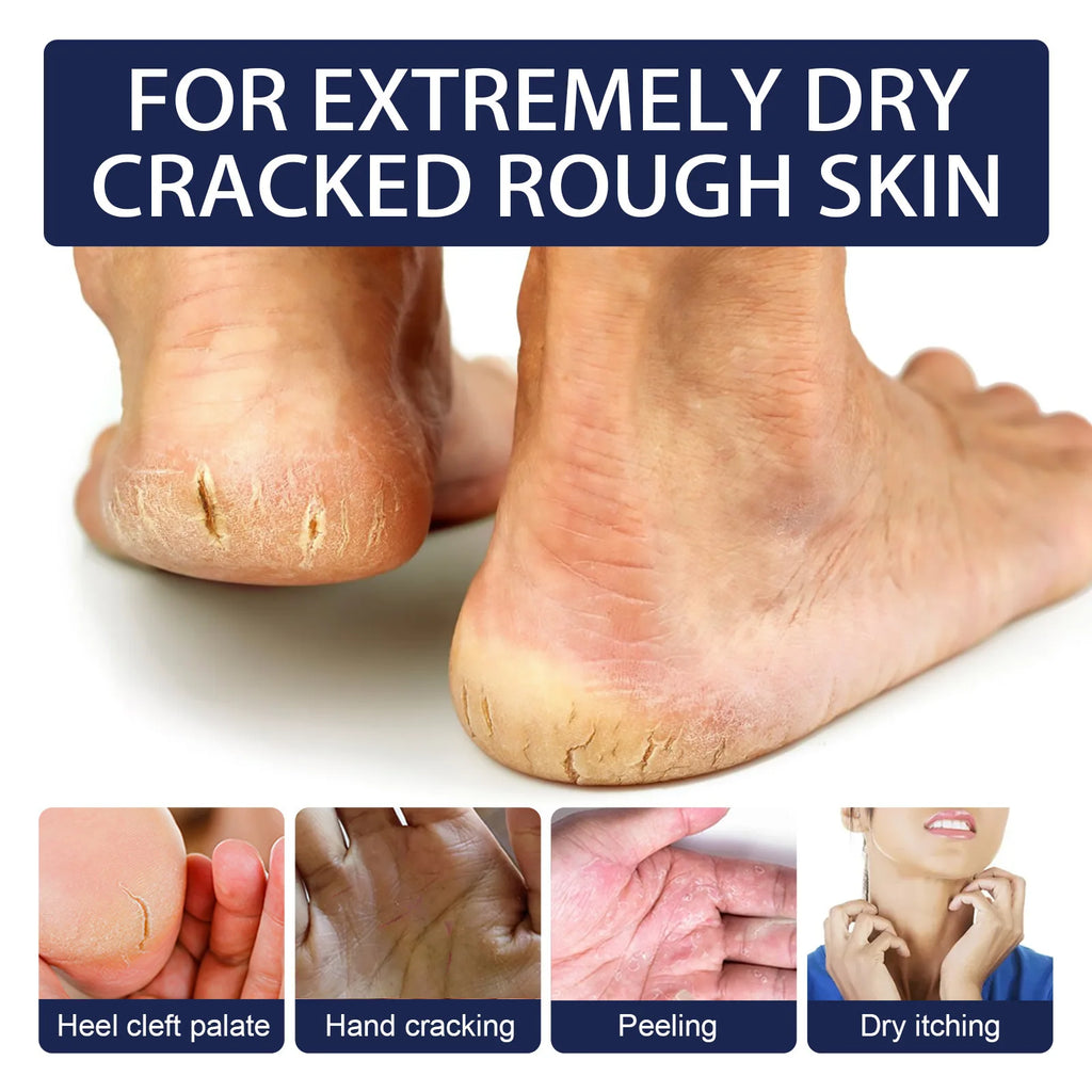 Anti Crack Cream Heel Chapping Repair Dead Skin Removal Anti-Drying Hand Treatment Nourishing Foot Dryness Cracked Repair Cream