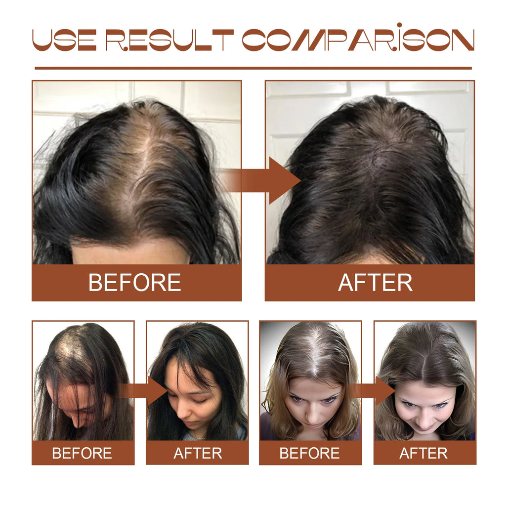 100% Natural Unrefined and Organic Batana Oil for Hair Growth & Strength, Prevents Hair Loss Eliminates Split Ends for Men Women