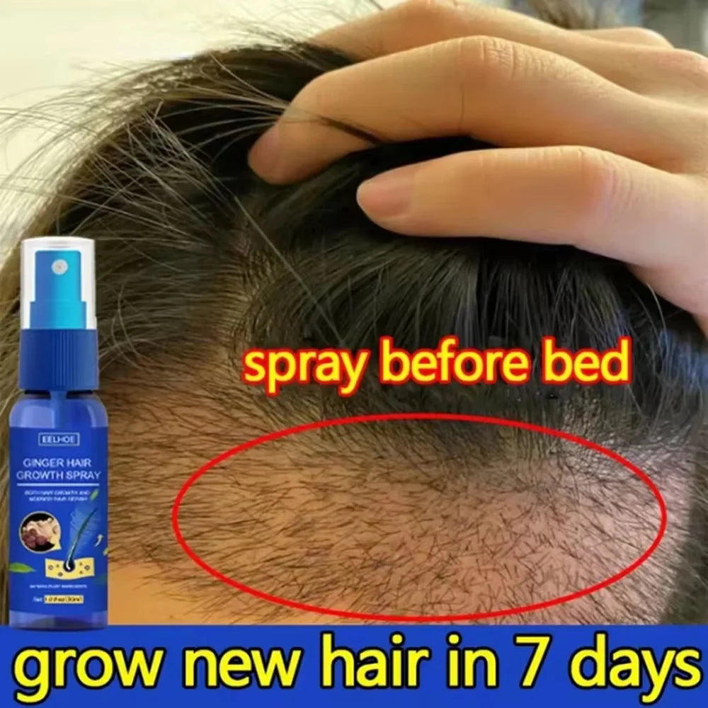 Ginger Hair Growth Spray Anti Hair Fall Hair Loss Treatment Hair Growth Essence Oil for Men Women Hair Treatment