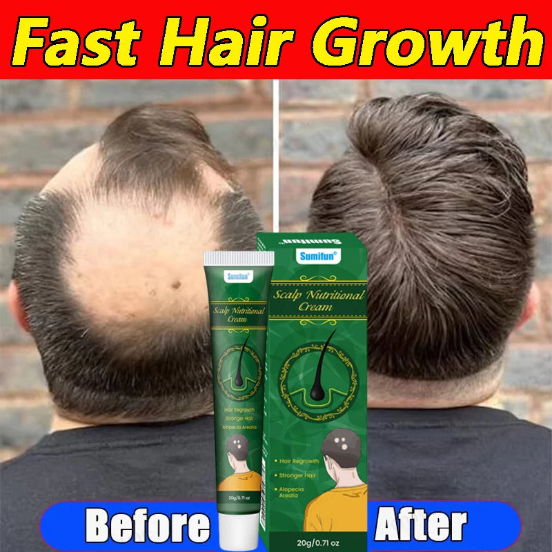 8 Days Fast Hair Growth Cream Anti Hair Loss Prevent Baldness Scalp Treatment Repair Roots Beauty Health Hair Care For Men Women