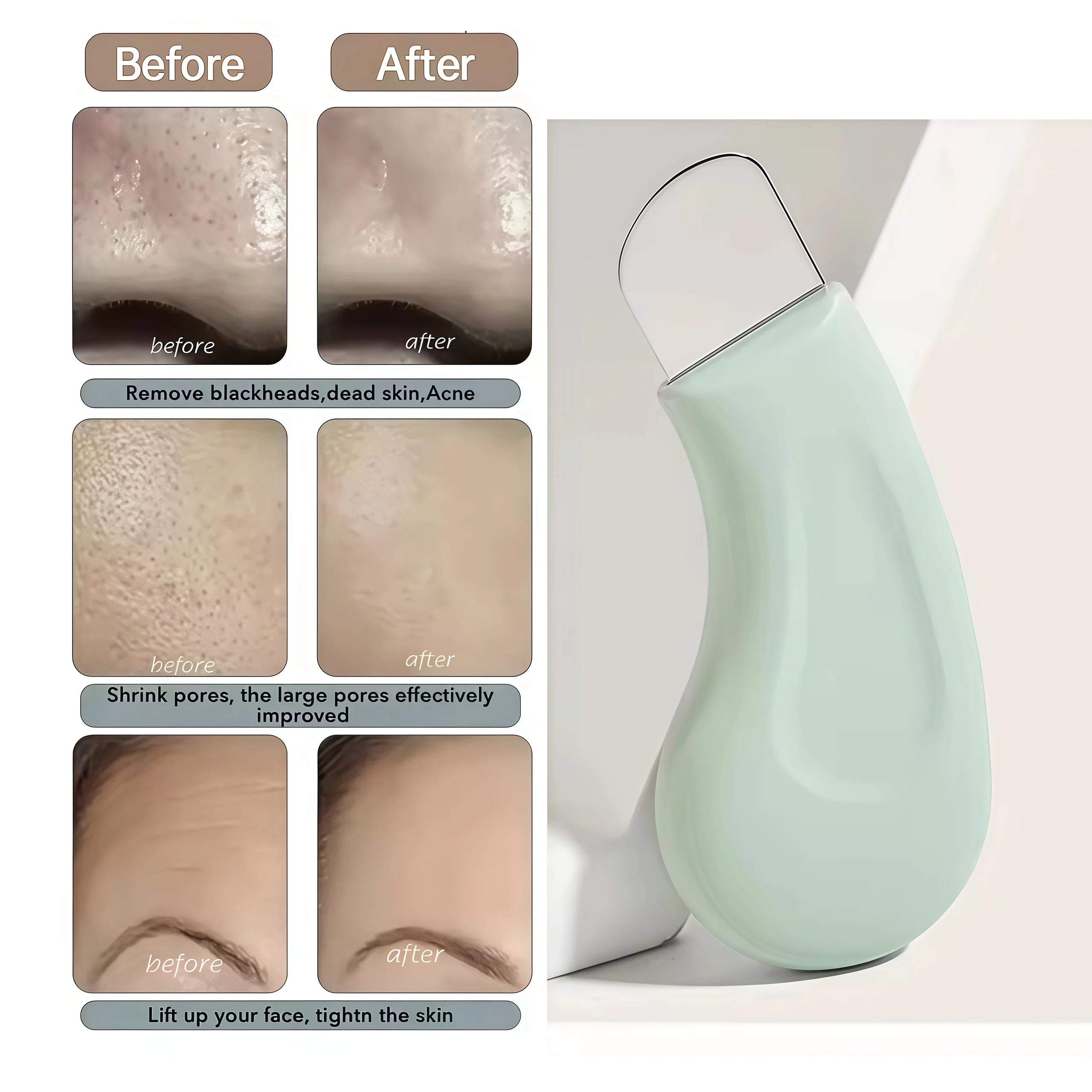 New Cat's Paw Blackhead Removal Tool - Perfect for Removing Pimples and Blemishes, Gentle Pore Cleansing, Exfoliating, Easy to H