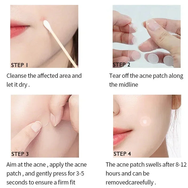 72pcs Invisible Acne Patches Waterproof Pimple Anti-Acne Hydrocolloid Patches Spots Marks Concealer Repair Sticker Skin Care