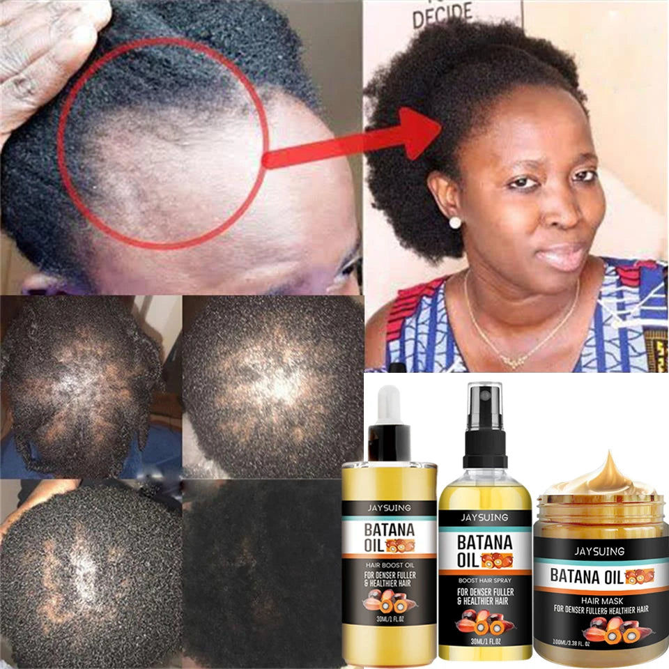 Fast Hair Growth Oil Africa Crazy Traction Treatment Hair Loss Spray Hair Regrowth Powerful Hair Root Repair Hair Mask Hair Care