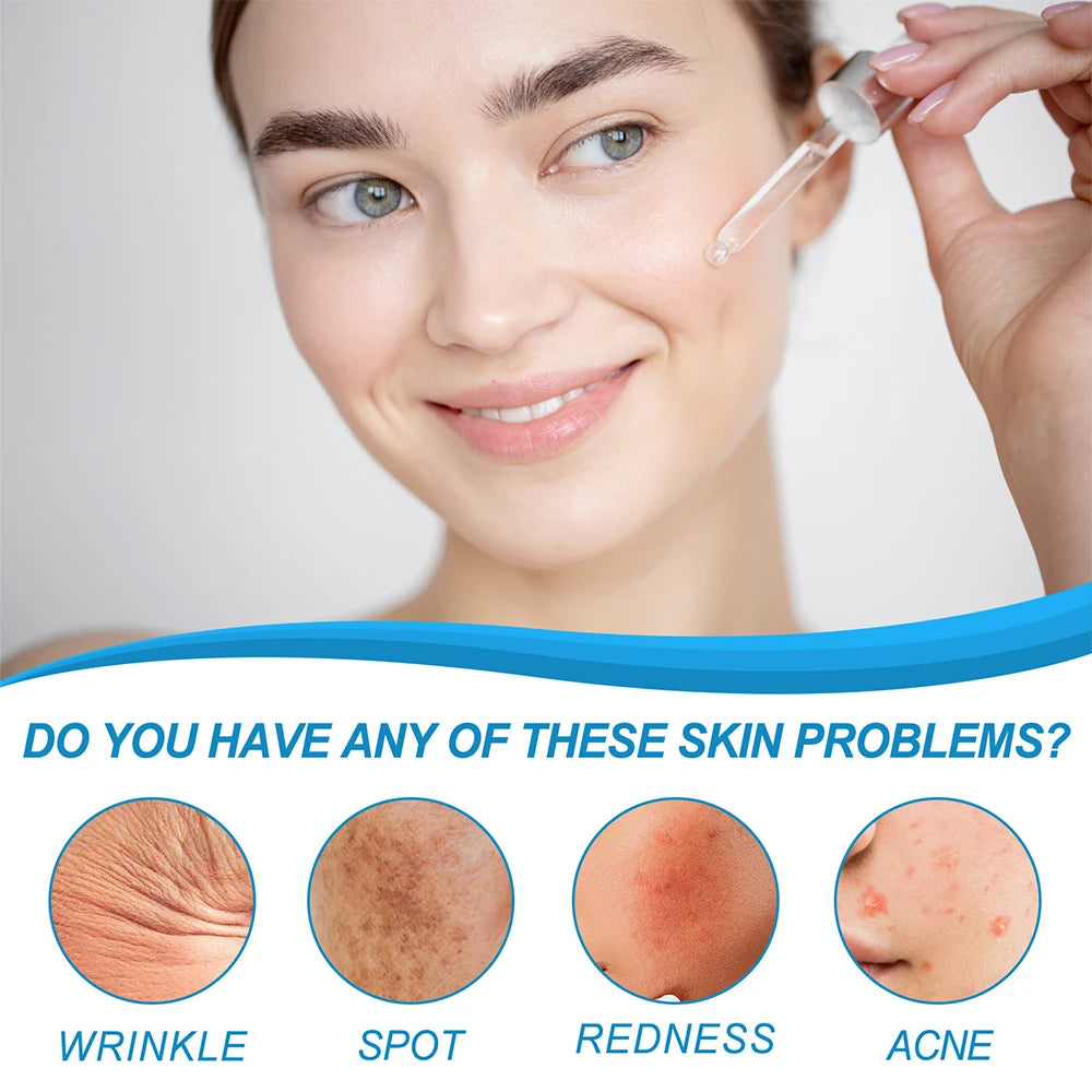 YOUNGCOME HYALU B5 Serum Anti -Wrinkle Collagen Instant Face Tightening Fade Fine Lines Hydrating for Plumping