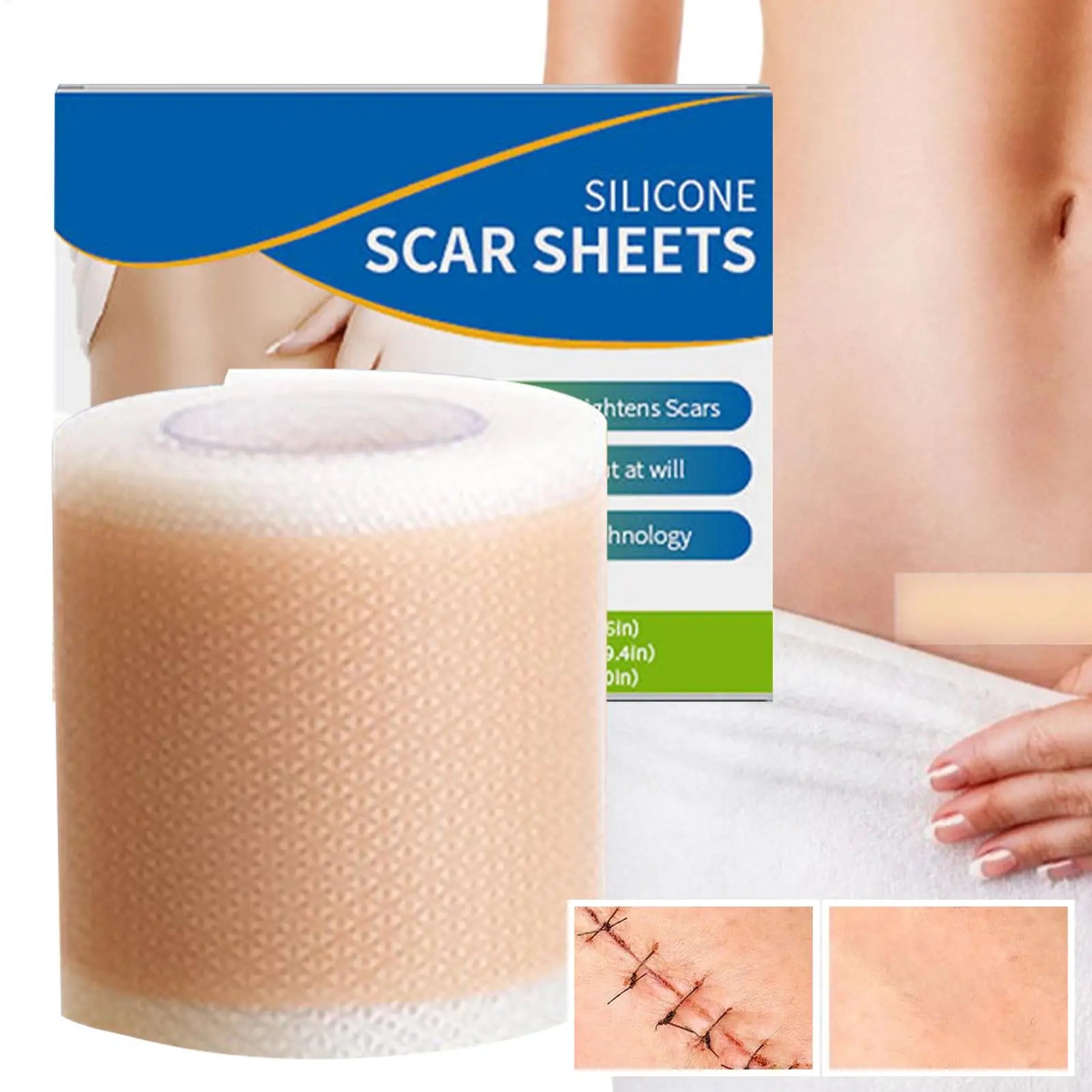 Painless Scar Repair Tape Silicone Scar Removal Strip Reusable Effective Skin Care Strips For Surgerys Burn Acne Scar