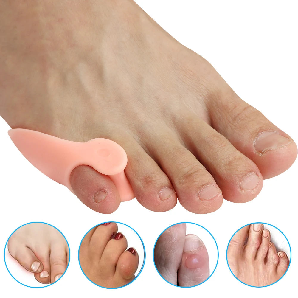 Gel Pinky Toe Separators – 2 to 20 Pack