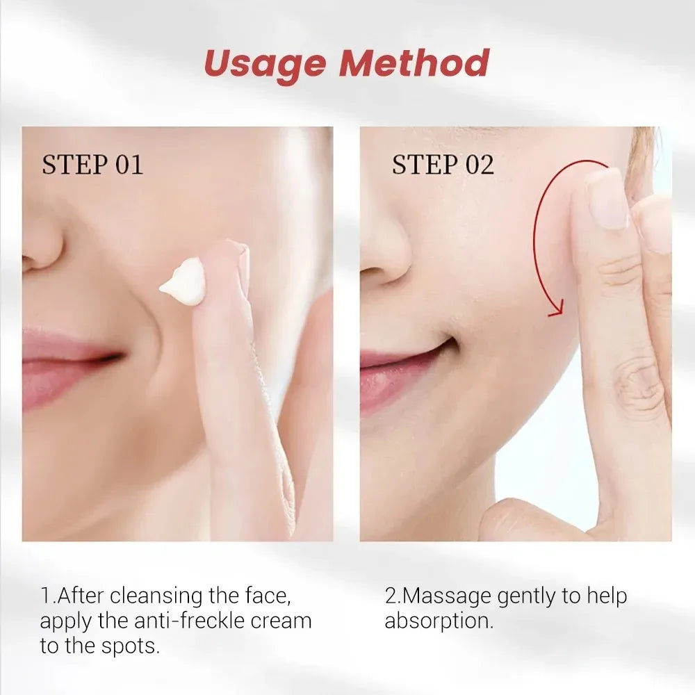 1/3/5pc Effective Freckle Cream Facial Fast Brighten Face Remove Melasma Dark Spot Fade Melanin pigmentation Improve Dullness